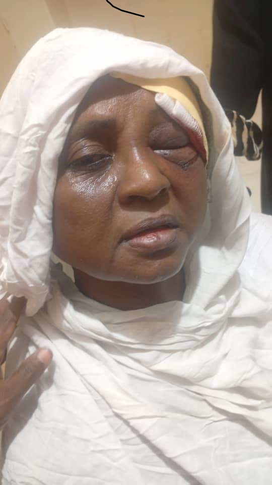 أصدرت اللجنة التسييرية لنقابة المحامين الفرعية مروي -كريمة -الدبة بيان حول الاعتداء علي المحامية إزدهار جمعة سعيد وكشف البيان عن تعرض المحامية للاختطاف من قبل قوة مسلحة أول أمس واقتادتها بالقوة الي طريق صحراوي شمال مدينة كريمة واعتدت عليها بالضرب .